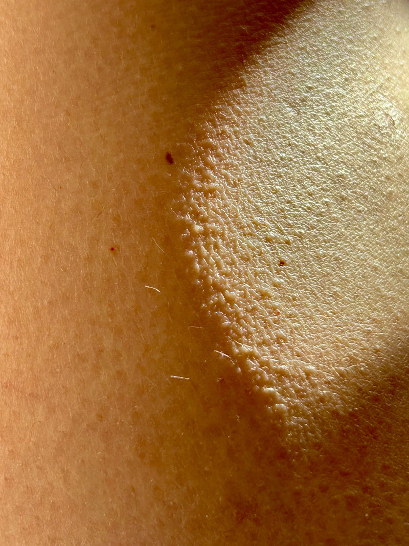 Skin that holds its shape again